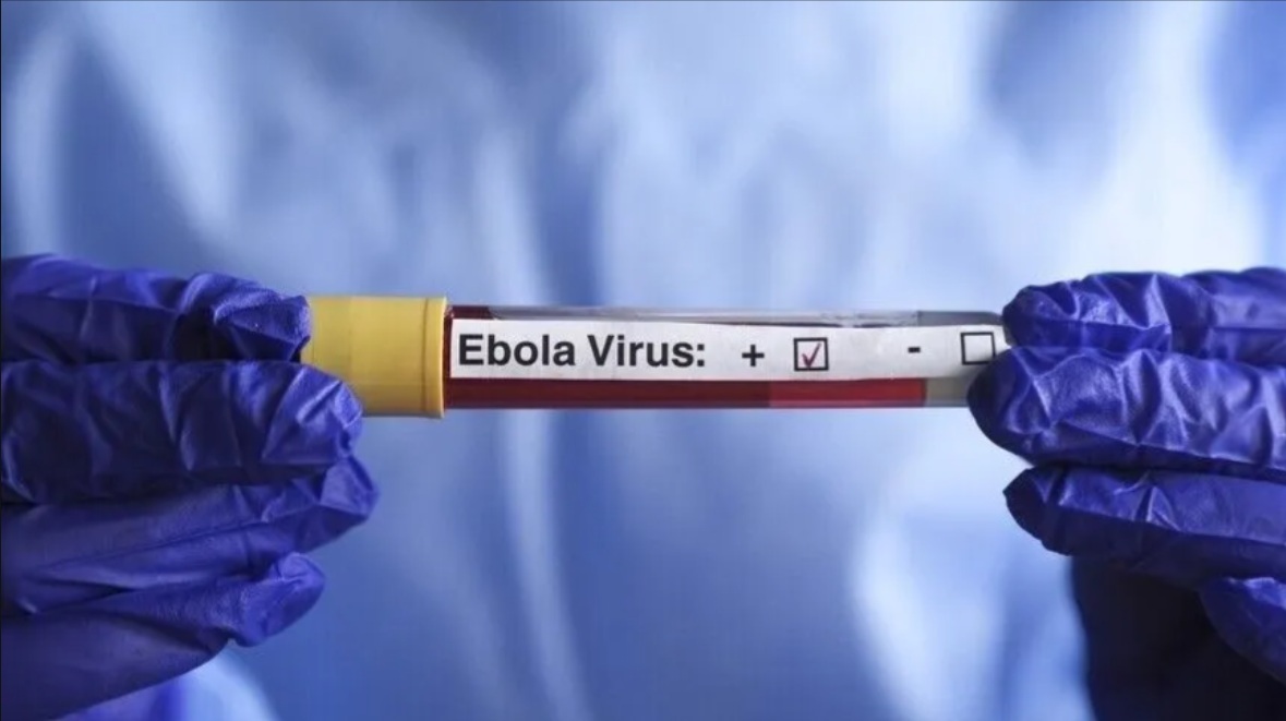 Ebola : le Bénin passe en phase de préalerte et renforce son dispositif de prévention